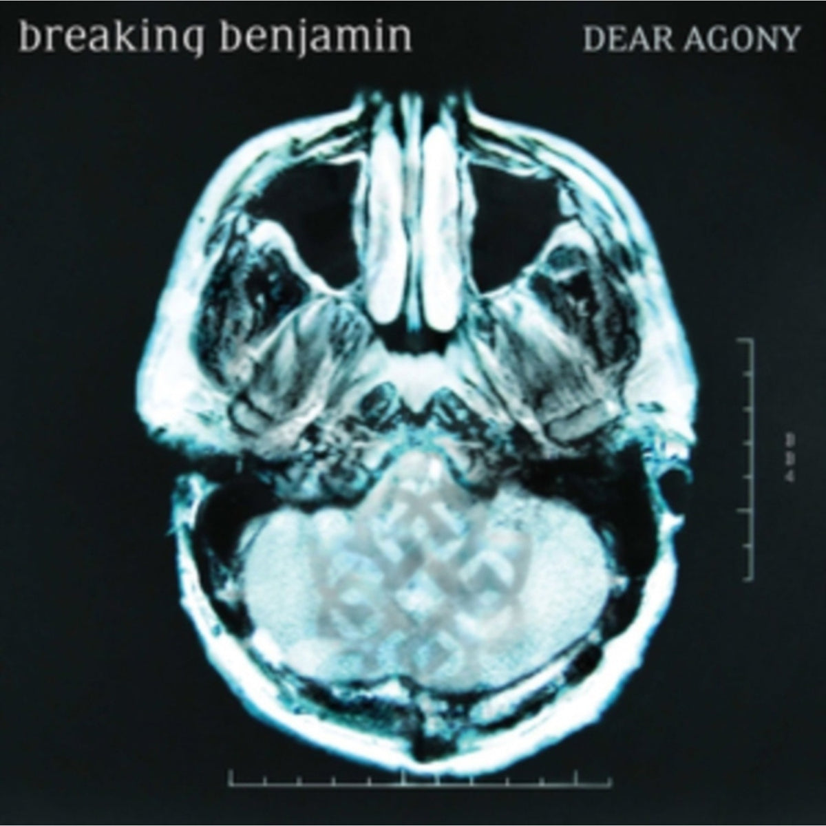 Phobia & Dear Agony & Saturate
