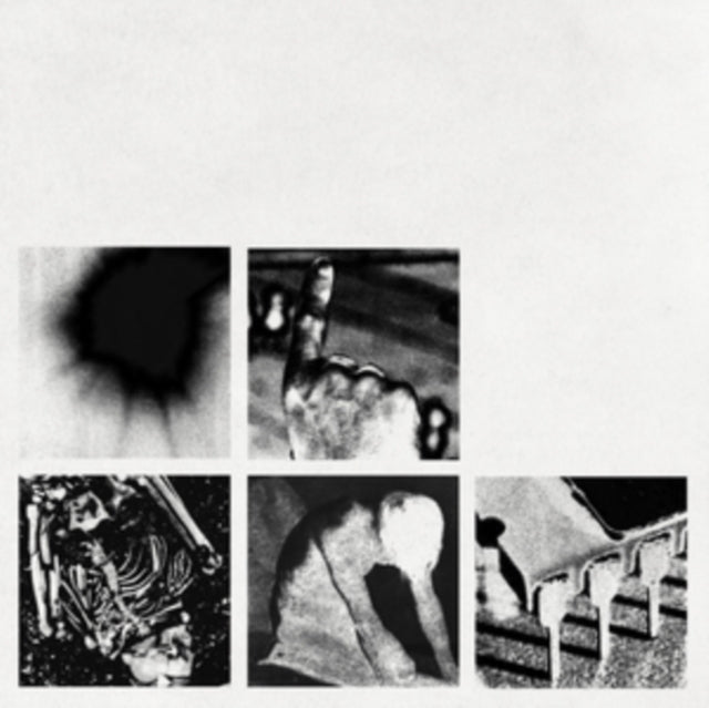 Fragile (3LP/180G/2016 Remaster) & Broken (180G/LP/7Inch) & Quake (2LP) & Bad Witch (LP)