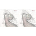 Dream (Milky Clear LP Vinyl) (I) & Dream
